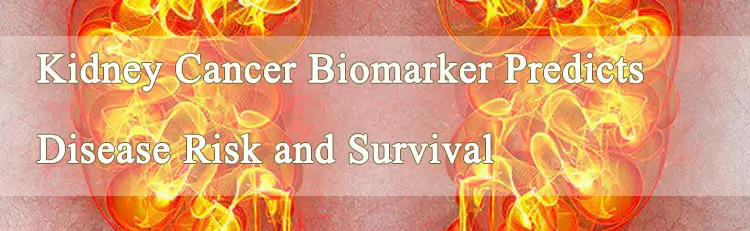 5-Kidney-Cancer-Biomarker-Predicts-Disease-Risk-and-Survival.webp