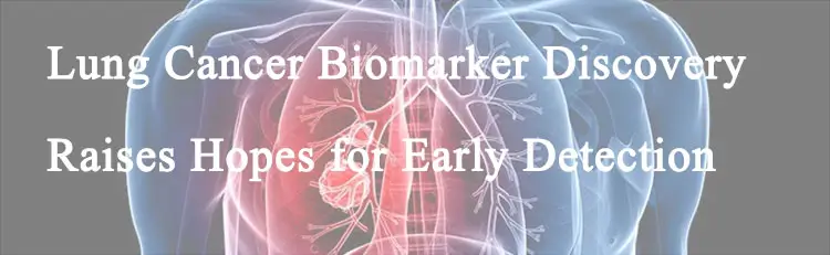 6-Lung-Cancer-Biomarker-Discovery-Raises-Hopes-for-Early-Detection.webp